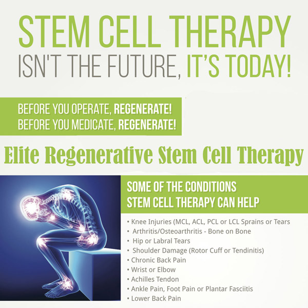 Stem Cell Therapy info sheet
